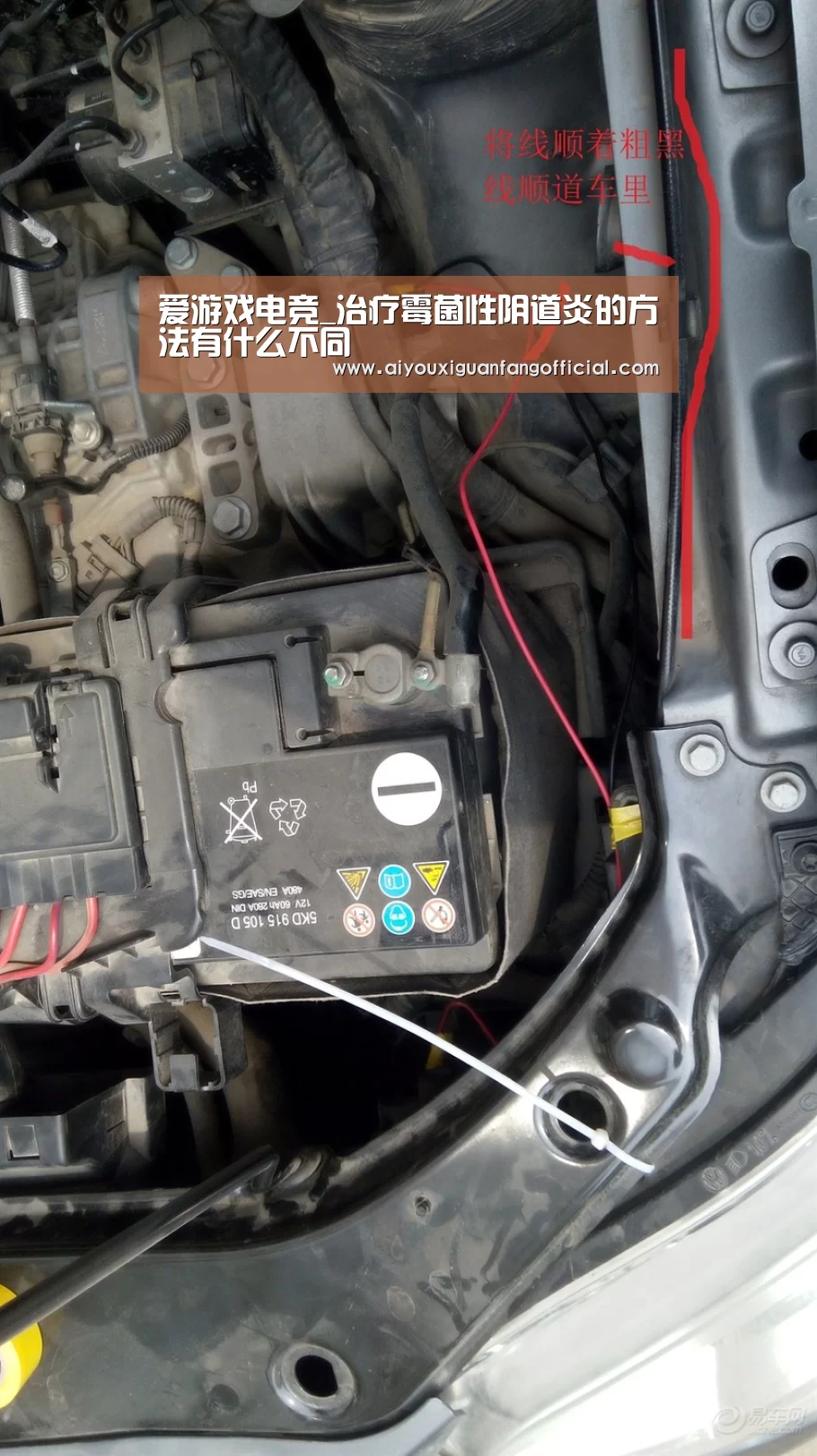 爱游戏电竞_治疗霉菌性阴道炎的方法有什么不同(图4) 爱游戏APP